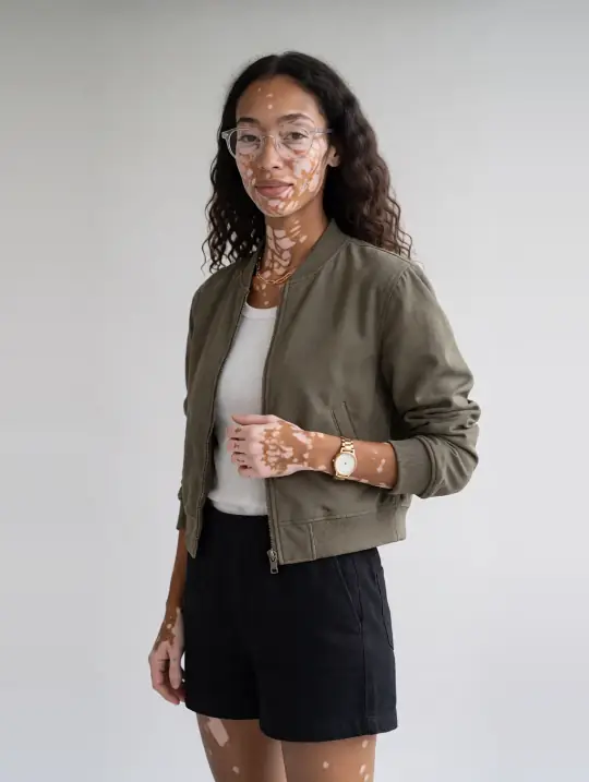 Zara, an A Pose Studio AI model: Mixed heritage, early 30s, vitiligo